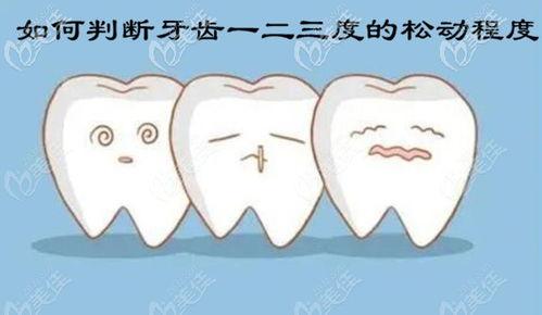 牙齿一二三度松动视频,牙齿松动程度分级及应对策略